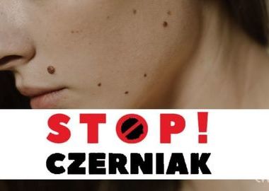 Ilustracja do artykułu: 'Stop! Czerniak' - badania dziś na Rynku!