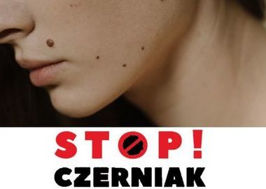 Ilustracja do artykułu: Stop! Czerniak - bezpłatne badania w każdą środę