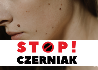 Ilustracja do artykułu: Bezpłatne badania dermatologiczne